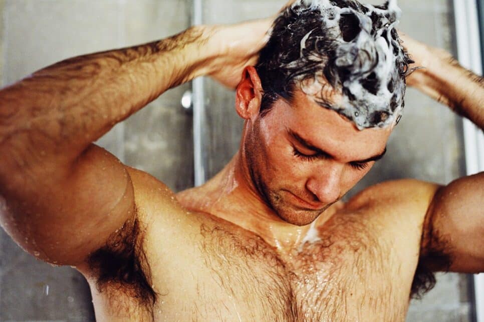 Cabelo Caspa Shampoo Anticaspa caseiro (GEORGE DOYLE/GETTY IMAGES)