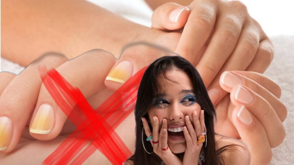 Unhas amareladas nunca mais! Mistura com 3 ingredientes em 10 minutos para branco original (Fotos: Reprodução/ Internet/ Freepik/ Montagem)