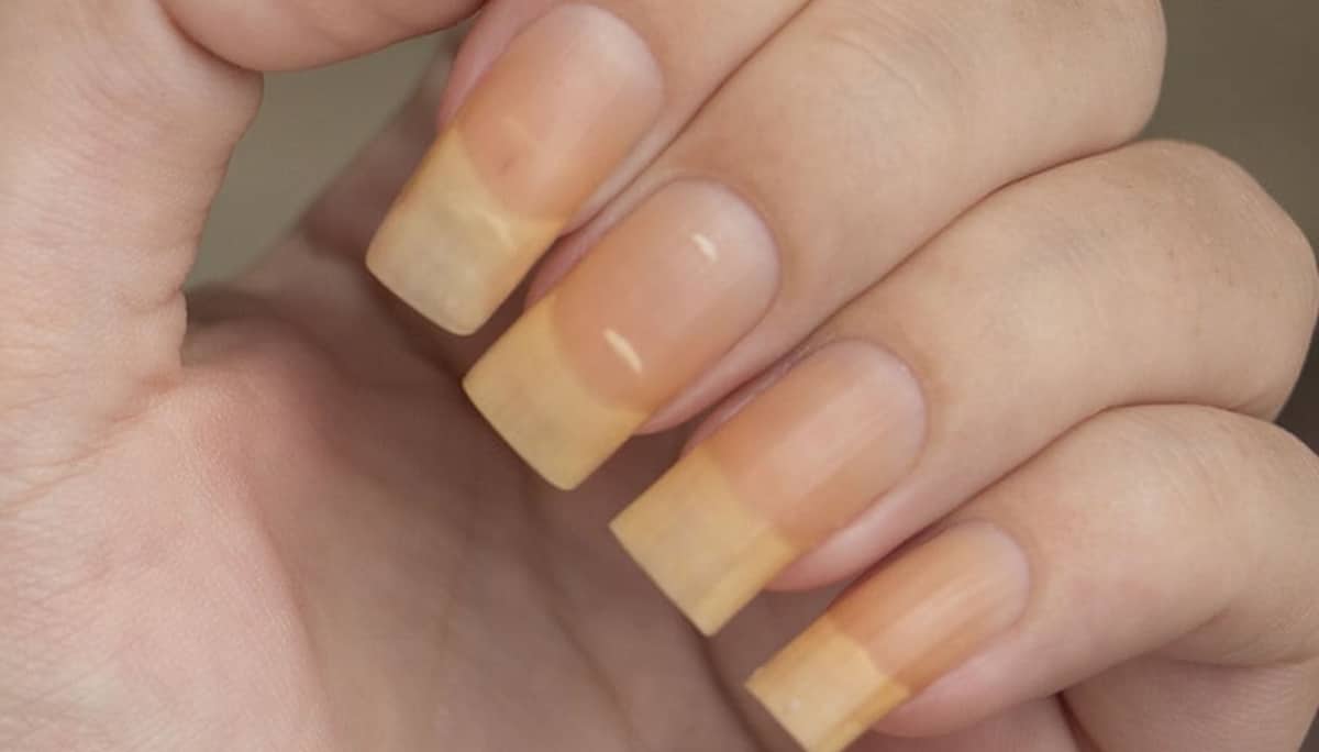 Tem as unhas amareladas ou manchadas? Receita caseira é a solução (Foto: Reprodução/ Internet)