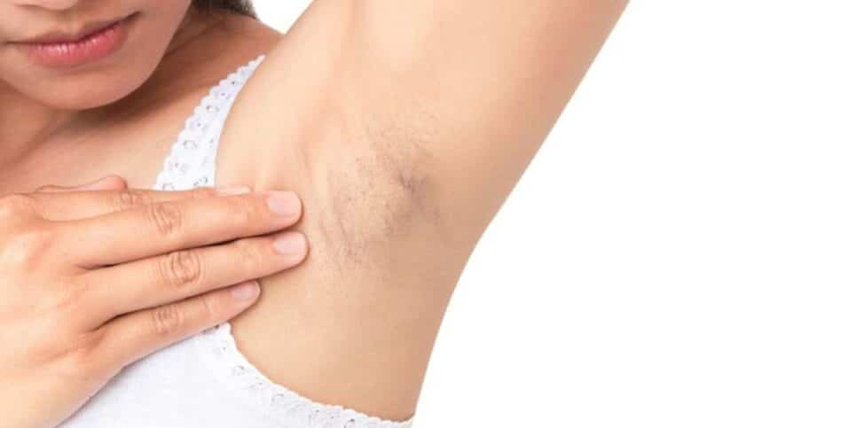 como clarear axilas e virilhas rapidamente com arroz e mais um ingrediente