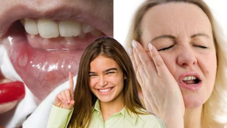 Afta ou mordeu a boca? Cicatrize feridas com 1 ingrediente da culinária (Fotos: Reprodução/ Internet/ Montagem)
