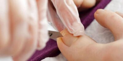 Sofrendo com unha encravada? Descubra métodos eficazes para tratar esse problema comum, mas sério  (Foto: Reprodução/Internet)