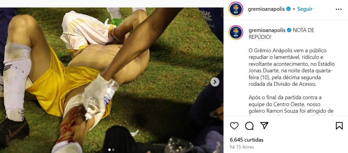  um policial atirou com bala de borracha no goleiro Ramón Souza, do Grêmio Anápolis (Foto: Reprodução/Instagram)