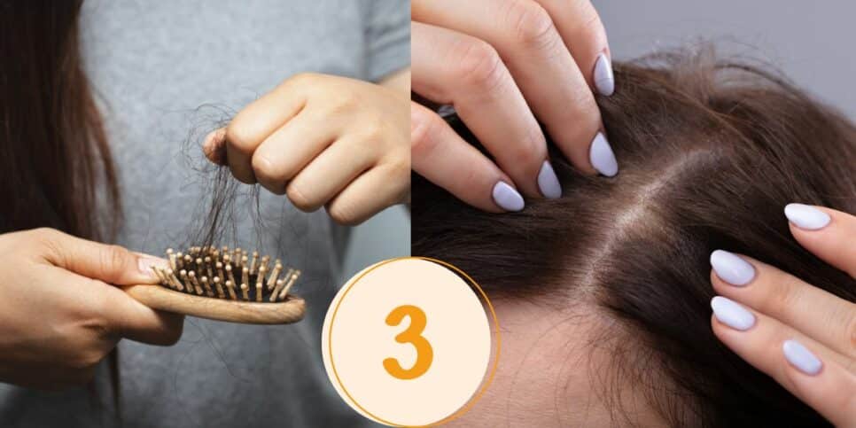Mulher com queda no cabelo (Foto: Reprodução / Canva / Montagem Hora do Benefício)