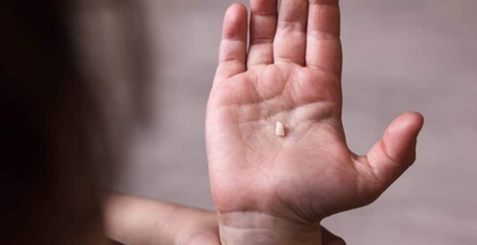 Sonho que perdeu um dente:? Descobrimos o significado disso (Foto: Reprodução/ Internet)